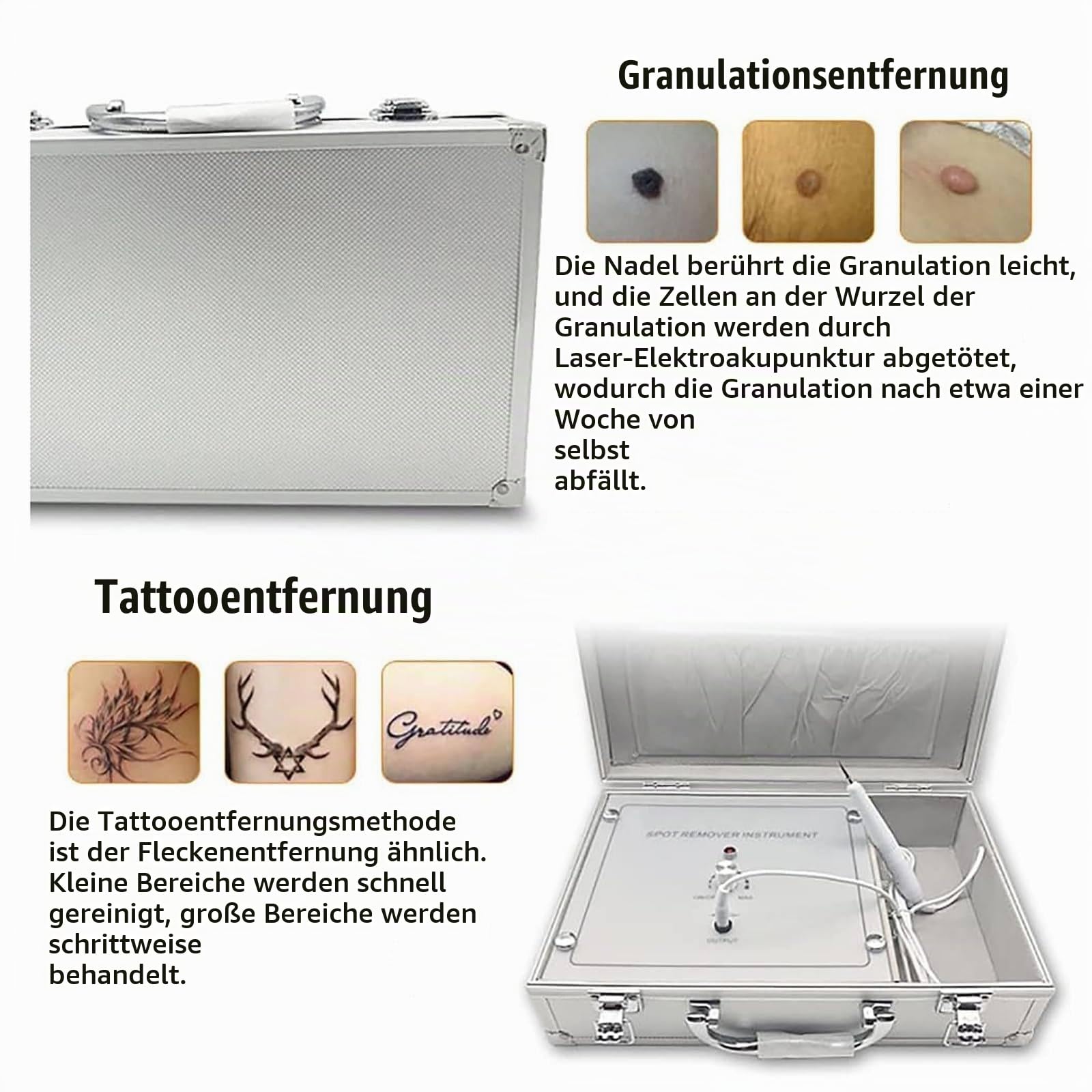 Plasmastift, Stift Zur Entfernung Von HautanhäNgseln, 10-Stufige Einstellung, Mit Grober Nadel + Feiner Nadel, Zur Entfernung Von Muttermalen, Flecken, Warzen Im Gesicht/KöRper