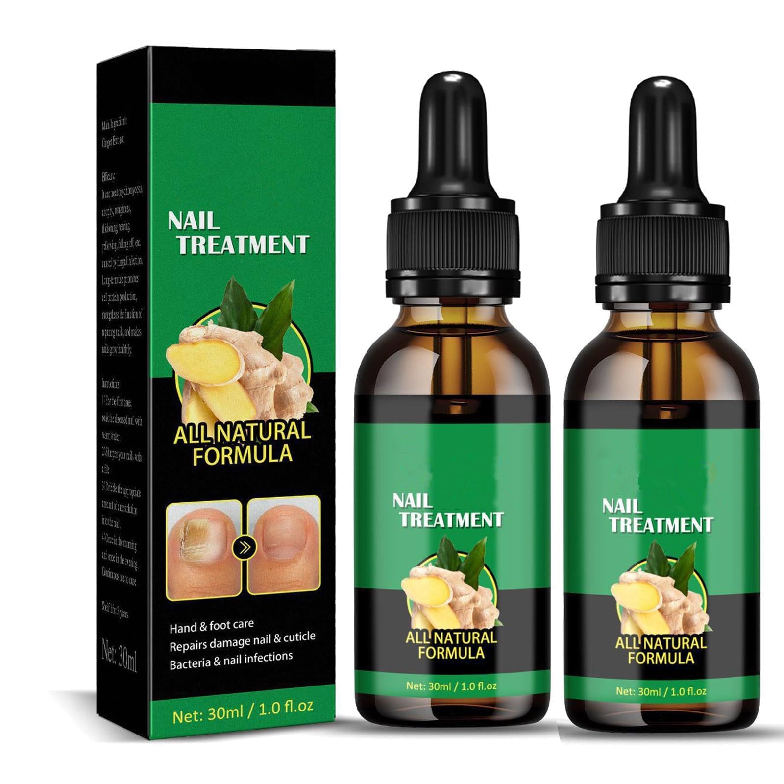 Ginger Nail Treatment Nail Support Nail Care, NailTreatment,Ginger NailGrowth Serum, Ginger NailTreatment, Ginger Cuticle Care Oil for DamagedNails (2pcs, 30ml)