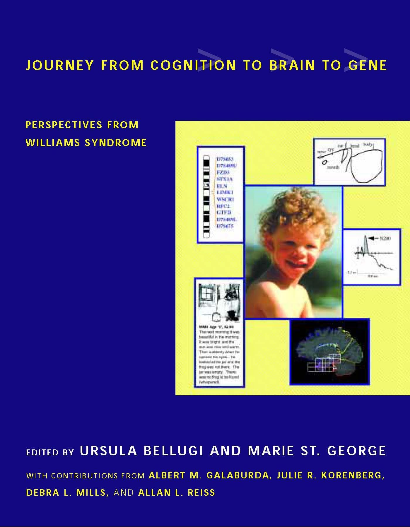 Buy Journey from Cognition to Brain to Gene: Perspectives from Williams Syndrome (Bradford Books) — BookShops.in