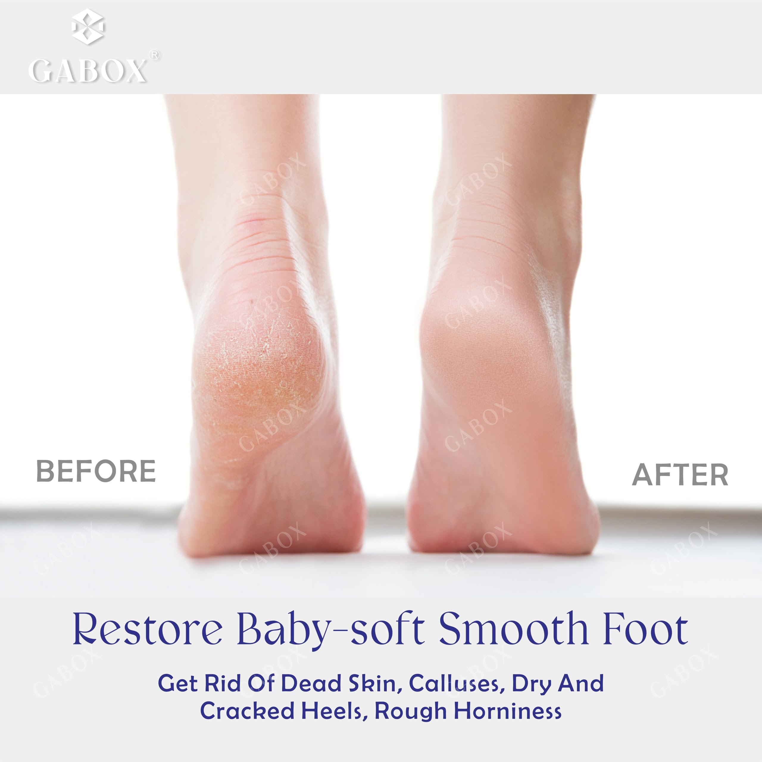 Removedor de callos para pies de piel muerta, raspador de talón de ducha, herramienta de pedicura para hombres y mujeres, spa de pies, azul cristal