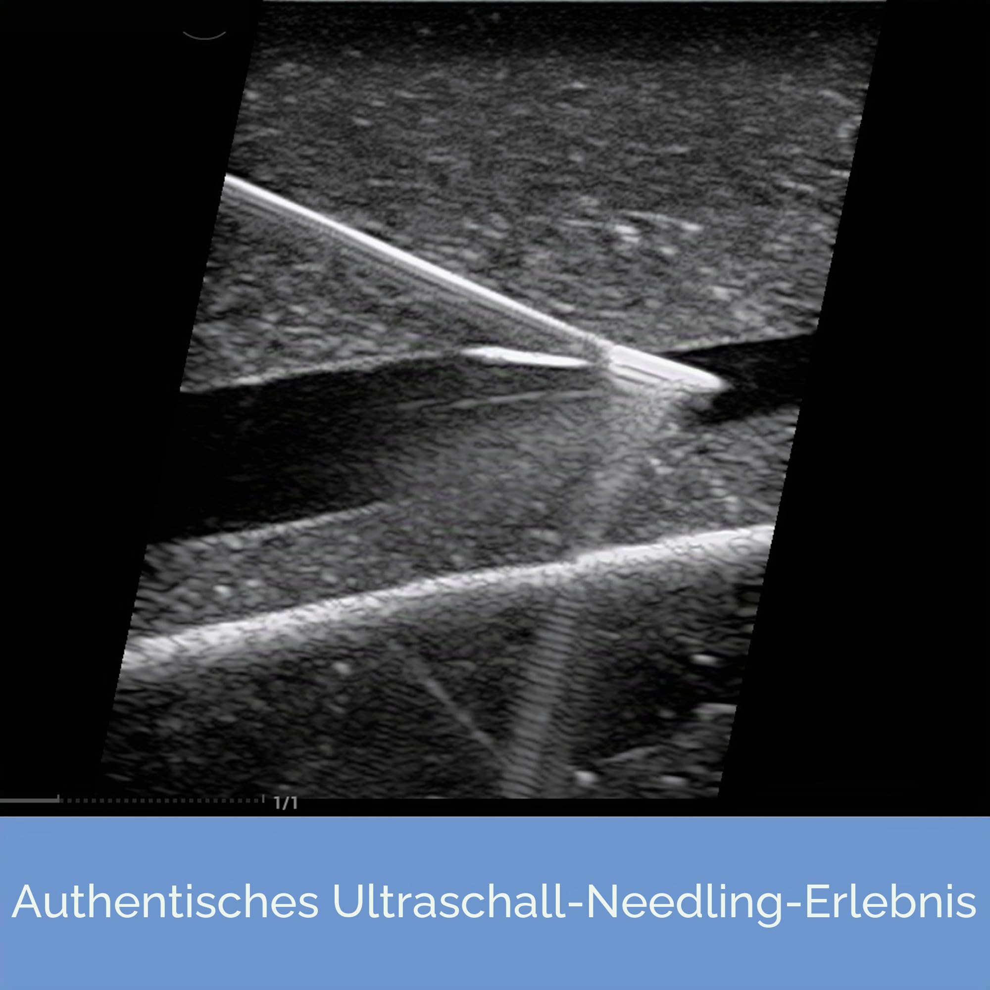 Ultraschall-Trainingspad – Ultraschall-Übungsmodell für Nadeleinführung, Gefäßsimulation, Trainingspad für medizinische Ausbildung