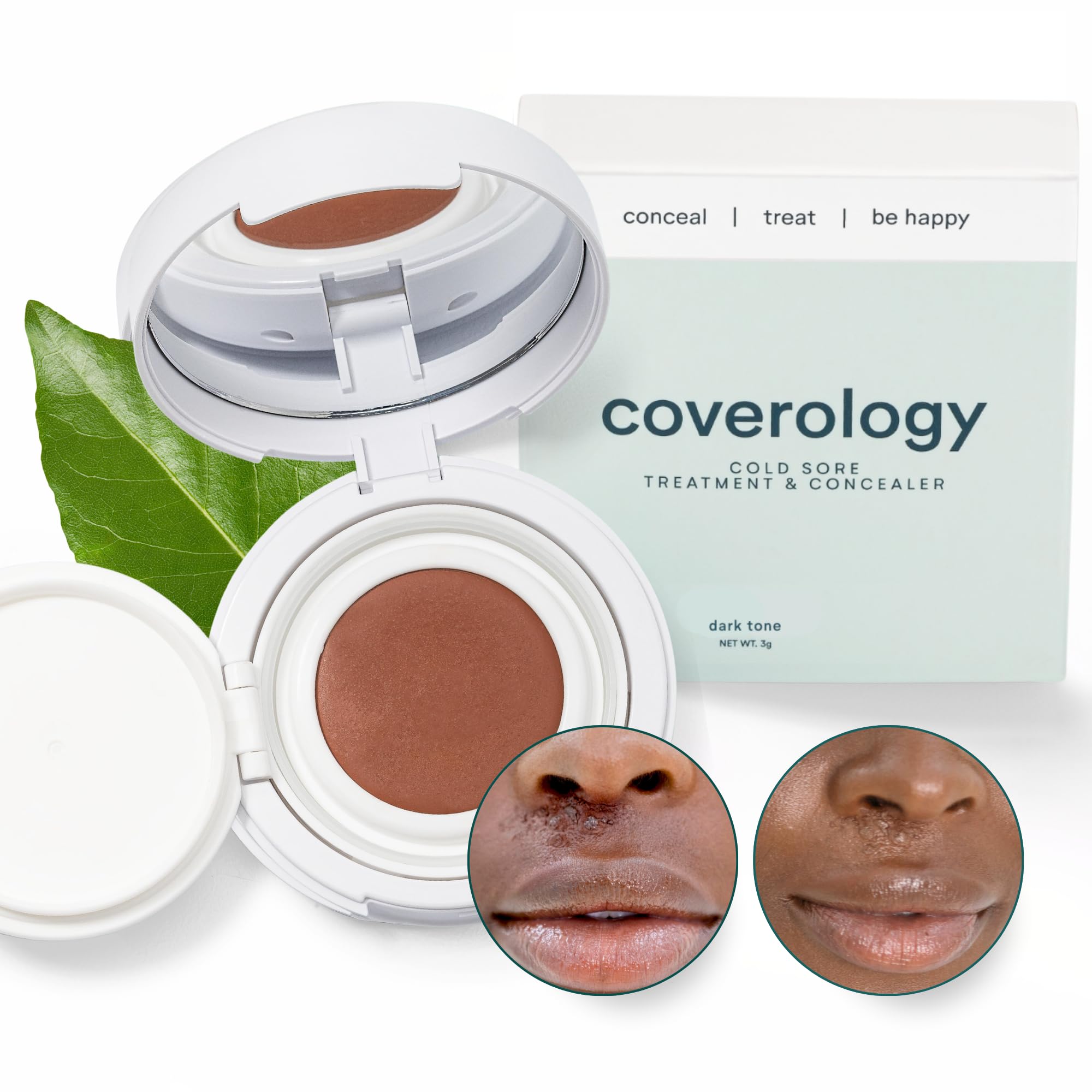 Coverology Cold Sore Treatment & Cold Sore Concealer - The Best Full Coverage Cold Sore Cover Up Makeup to Help Disguise and Soothe - Dark