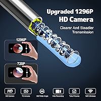 Vista 2 de Eliminación de cera de oídos, limpiador de oídos con cámara y luz, kit de eliminación de cera de oídos con otoscopio 1296P, herramienta de limpieza