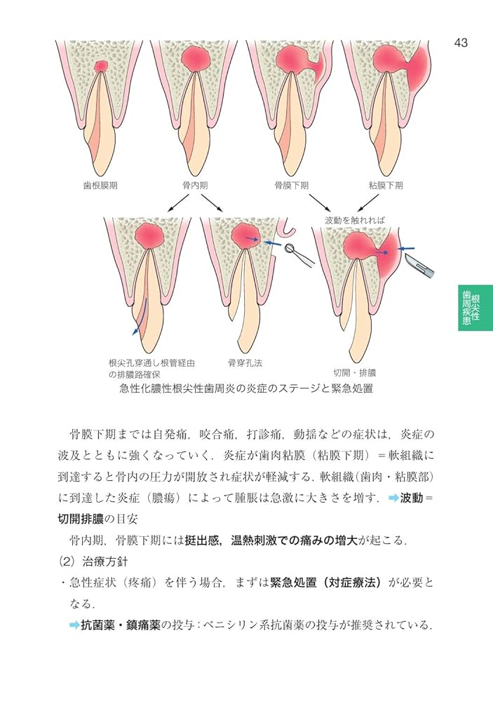 歯科国試パーフェクトマスター 歯内治療学 | 前田 博史, 前田