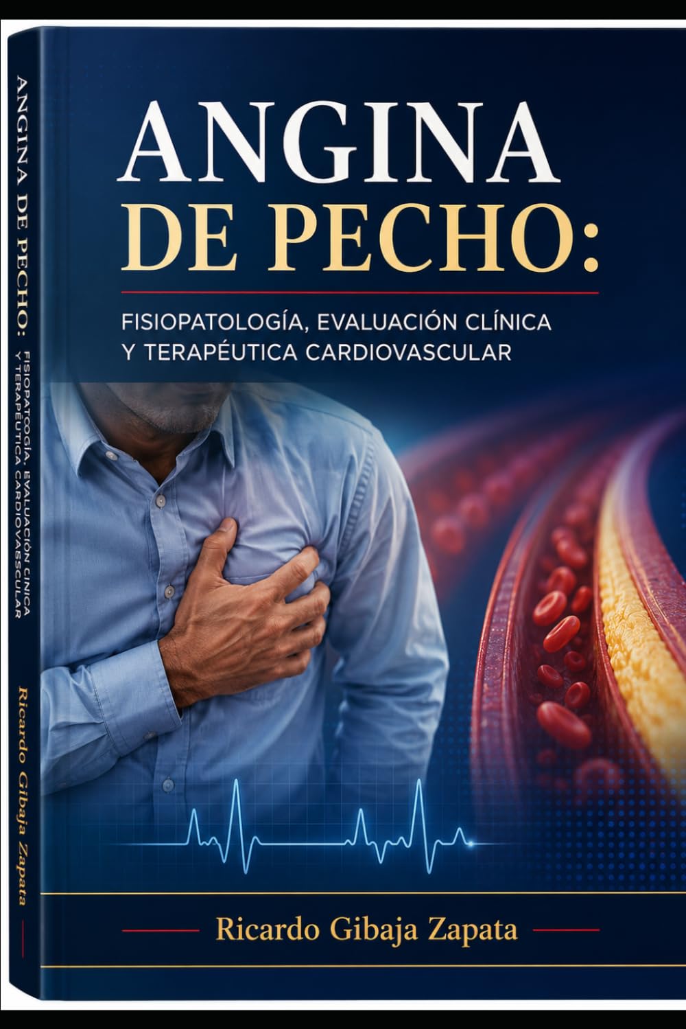 Angina de Pecho: Fisiopatología, Evaluación Clínica y Terapéutica Cardiovascular