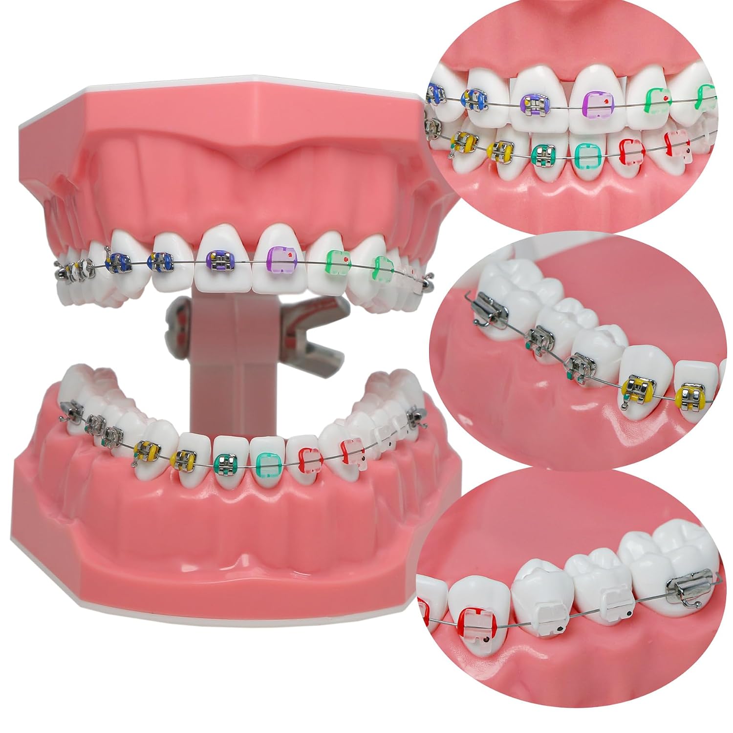 Dental Typodonts Orthodontics Demonstration Teeth Model with Metal Wires Colors Ligatures Ceramic Brackets Braces Teaching Learning Education Model for Adults and Kids