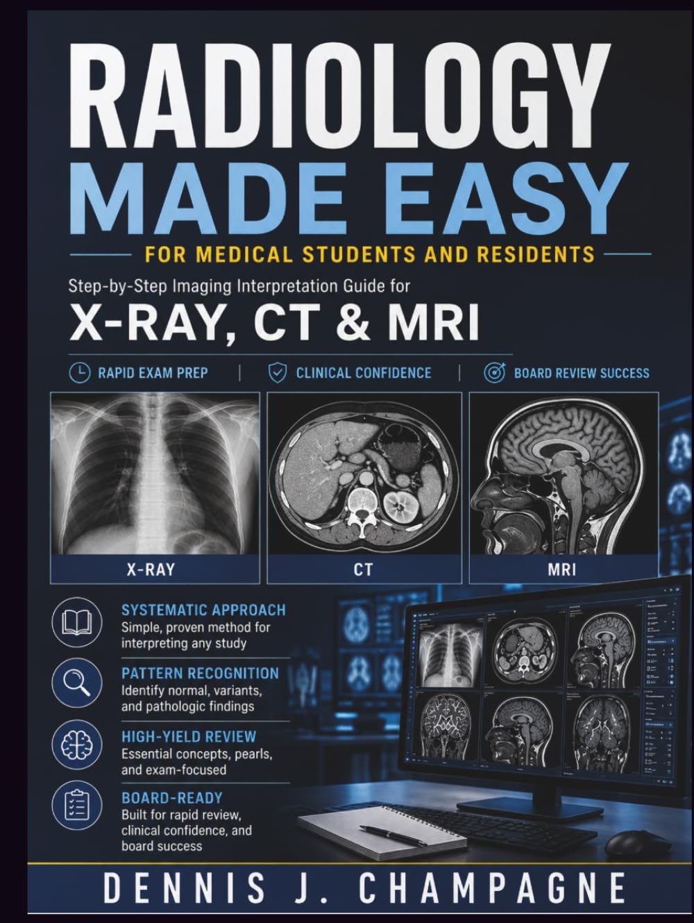 Radiology Made Easy for Medical Students and Residents: Step-by-Step Imaging Interpretation Guide for X-Ray, CT & MRI — Rapid Exam Prep, Clinical Confidence and Board Review Success (medical books)