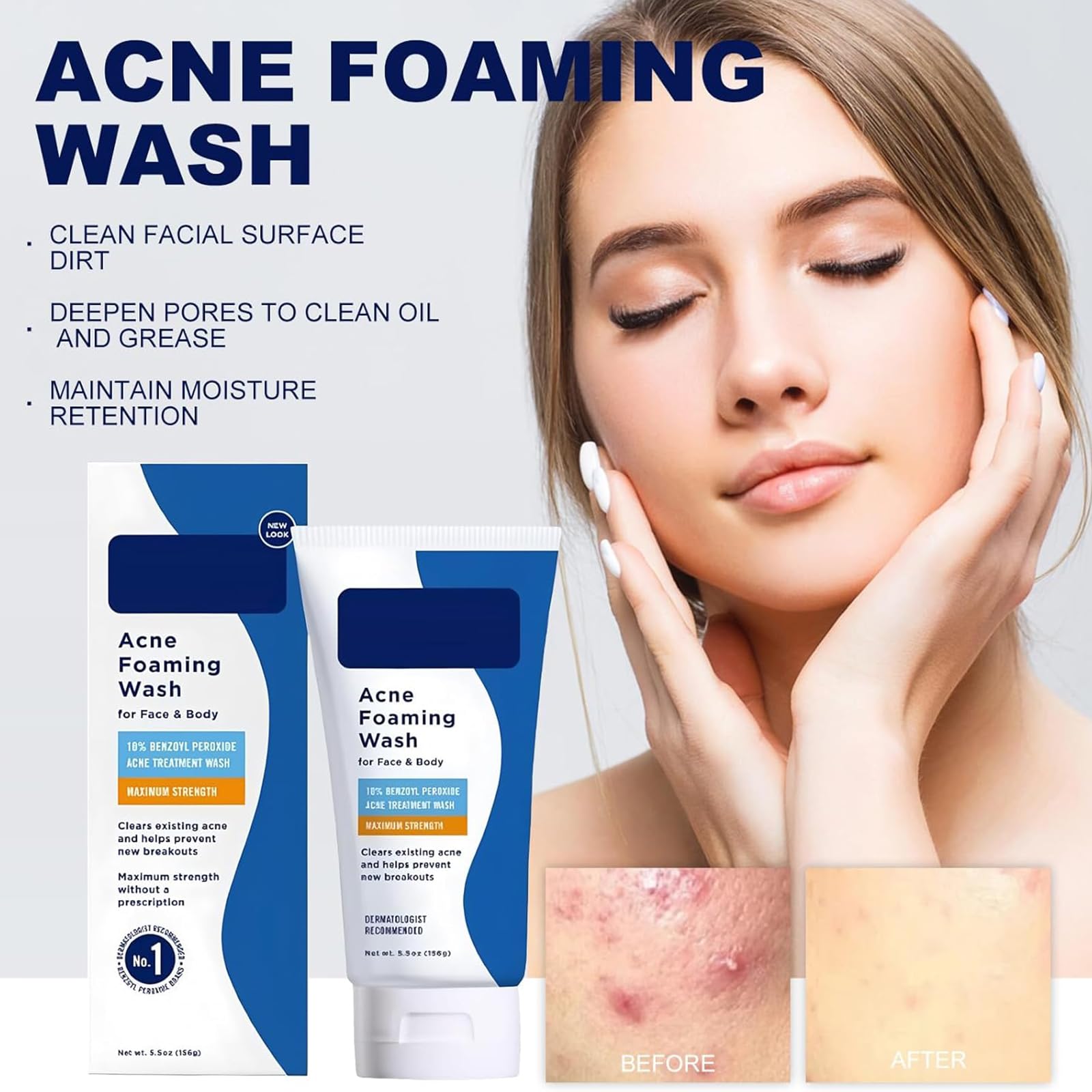 Acne Foaming Wash, Lozione detergente viso e corpo,Schiuma detergente per acne,Detergente viso morbido per la pulizia dei pori profondi