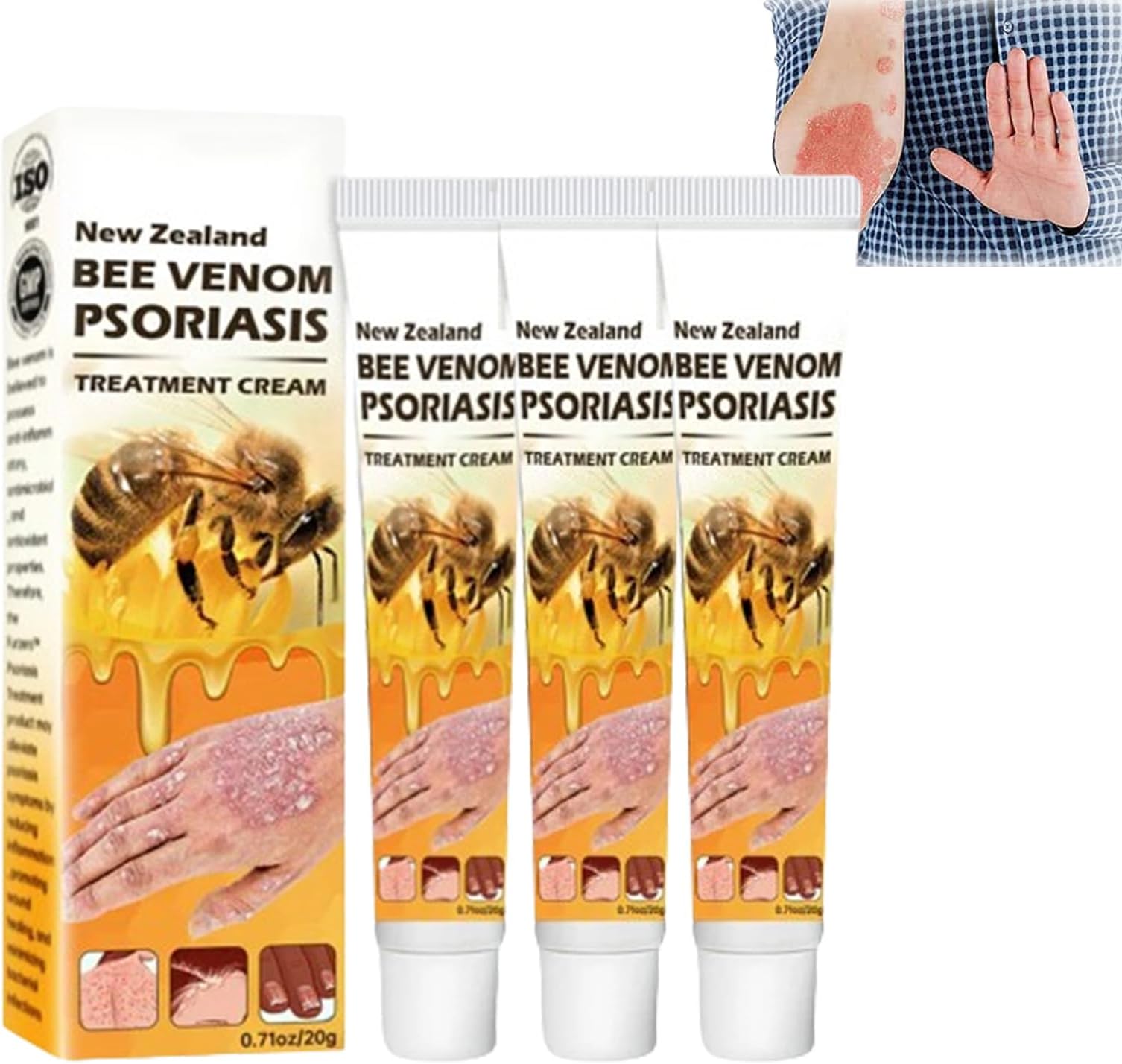 New Zealand Bee Venom Psoriasis Cream Treatment Cream, Bee Venom Psoriasis Treatment Cream, Bee Venom Psoriasis Cream, Soothing and Moisturizing Psoriasis Cream (3PCS)