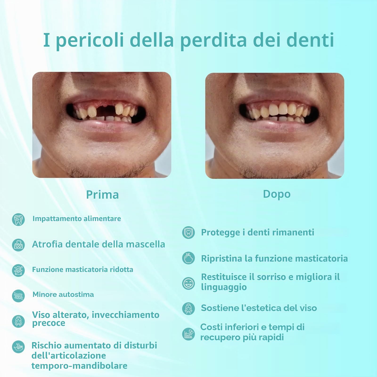 Protesi parziale su misura per gli spazi dentali: protesi provvisorie rimovibili per uomini e donne, protesi dentali con vestibilità perfetta. Facile da usare per il tuo sorriso perfetto a casa (2