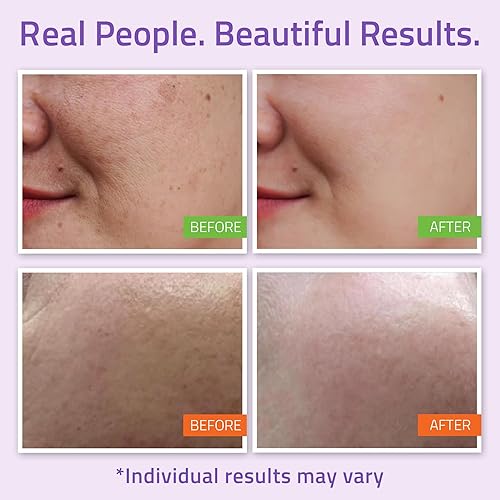 Miniatura 4 de El sistema más completo de antienvejecimiento para la piel, Yeouth, 5 Paquetes, tónico equilibrador para el rostro, suero con vitamina C, suero de