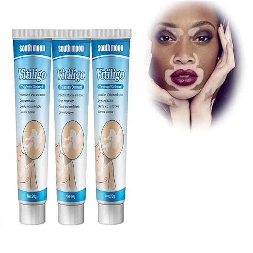 MEDix Vitiligo Treatment Cream,Vitiligo Cream Treatment,Vitiligo