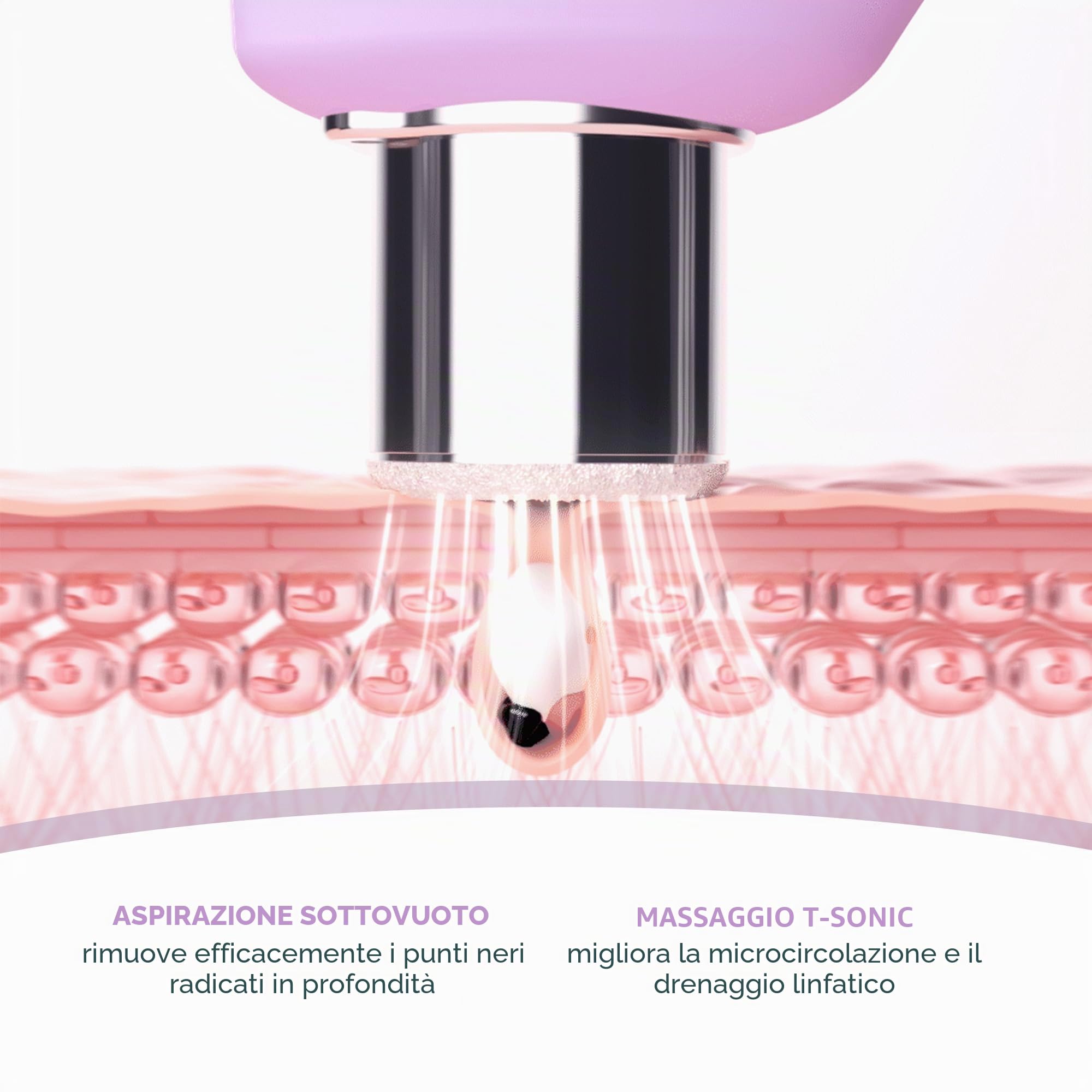 FOREO KIWI derma Aspiratore Punti Neri Microdermoabrasione viso Professionale Estrattore Punti Neri Viso e Naso