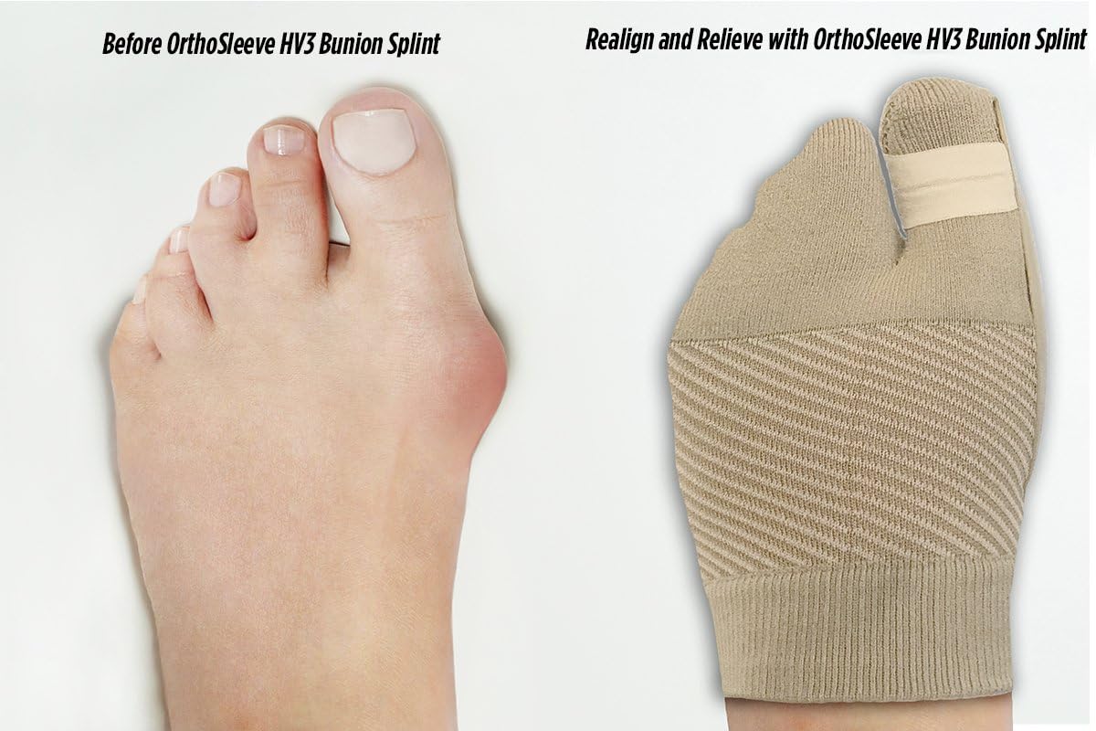 Orthosleeve 13342N HV3 Bunion Sleeve Plasters, Black, XL - Image 4