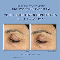 Vista 2 de RoC conjunto de reparación de arrugas profundas, corrección con retinol