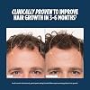 Nutrafol Hair Growth Nutrition Supplement for Men Clinically Proven for Thicker Looking Stronger Hair and More Scalp Coverage (2 Months Supply) (2 Bottles)