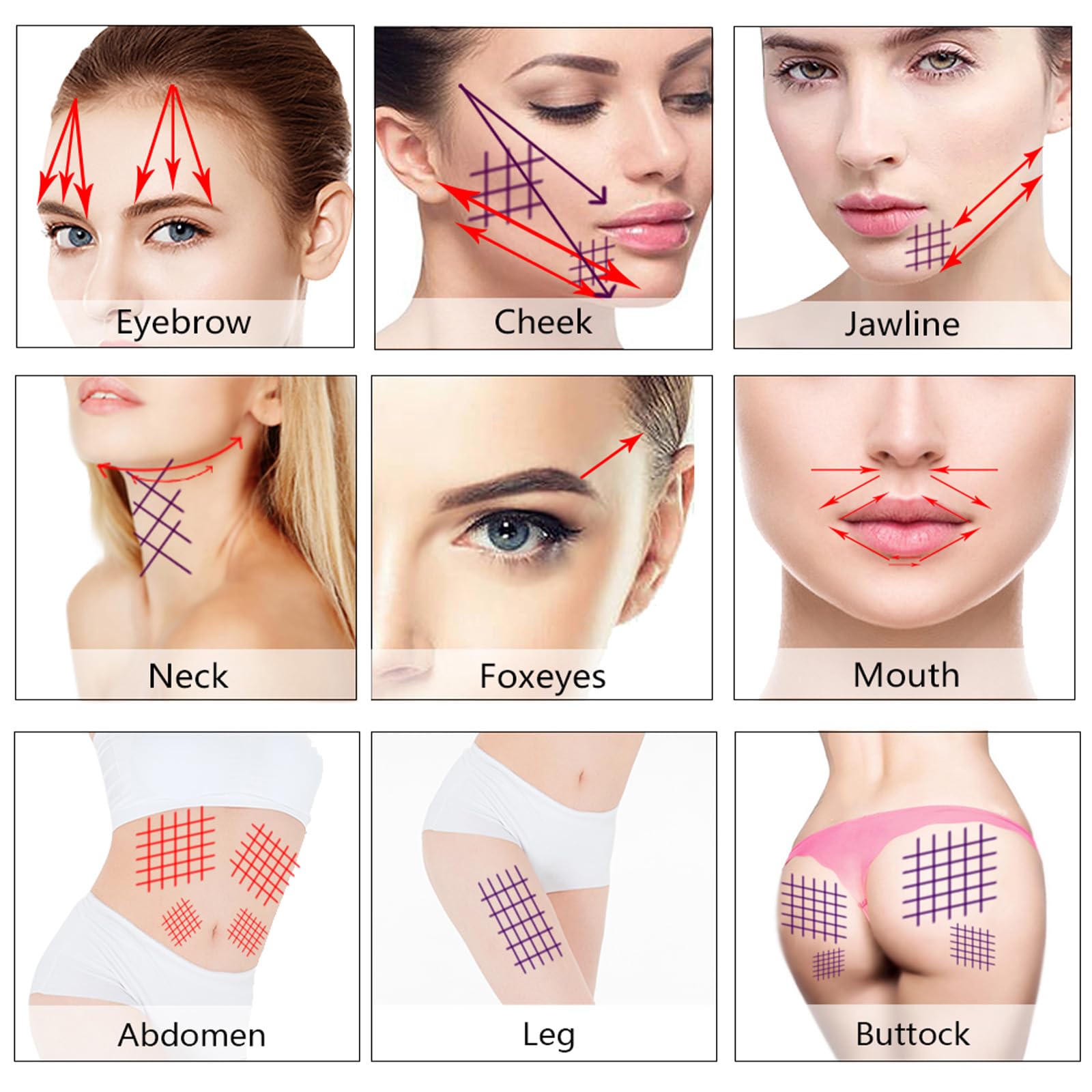 PDO Threads Mono Type Face Lift Whole Body Tightening 100pcs,26G-60MM 29G-38MM 29G-25MM Drei Größenoptionen (29G*38MM)