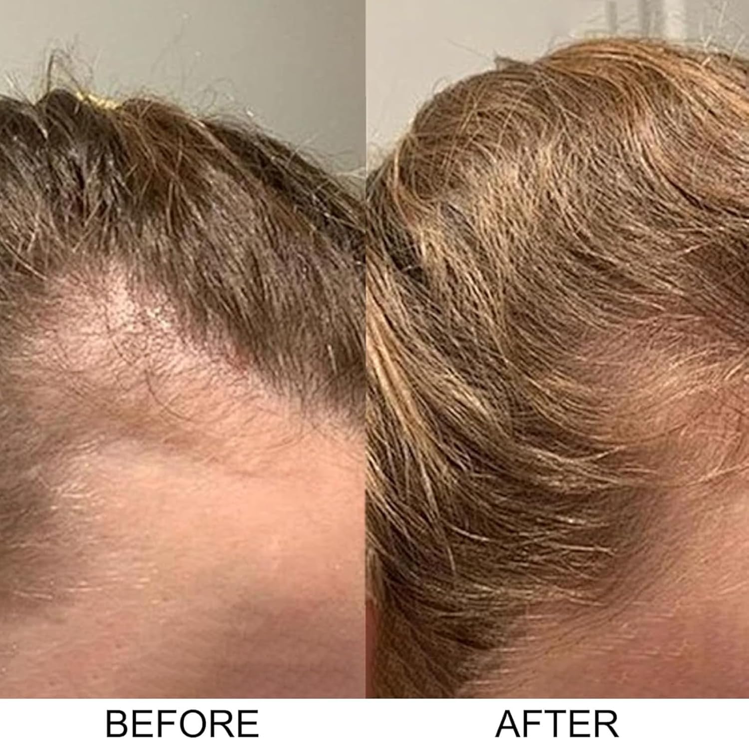Onion Shampoo, Shampoo De Cebolla Less Hair Loss, More Density, Stronger Roots for Women and Men, 7 oz/200 ml (1pcs) — view 6