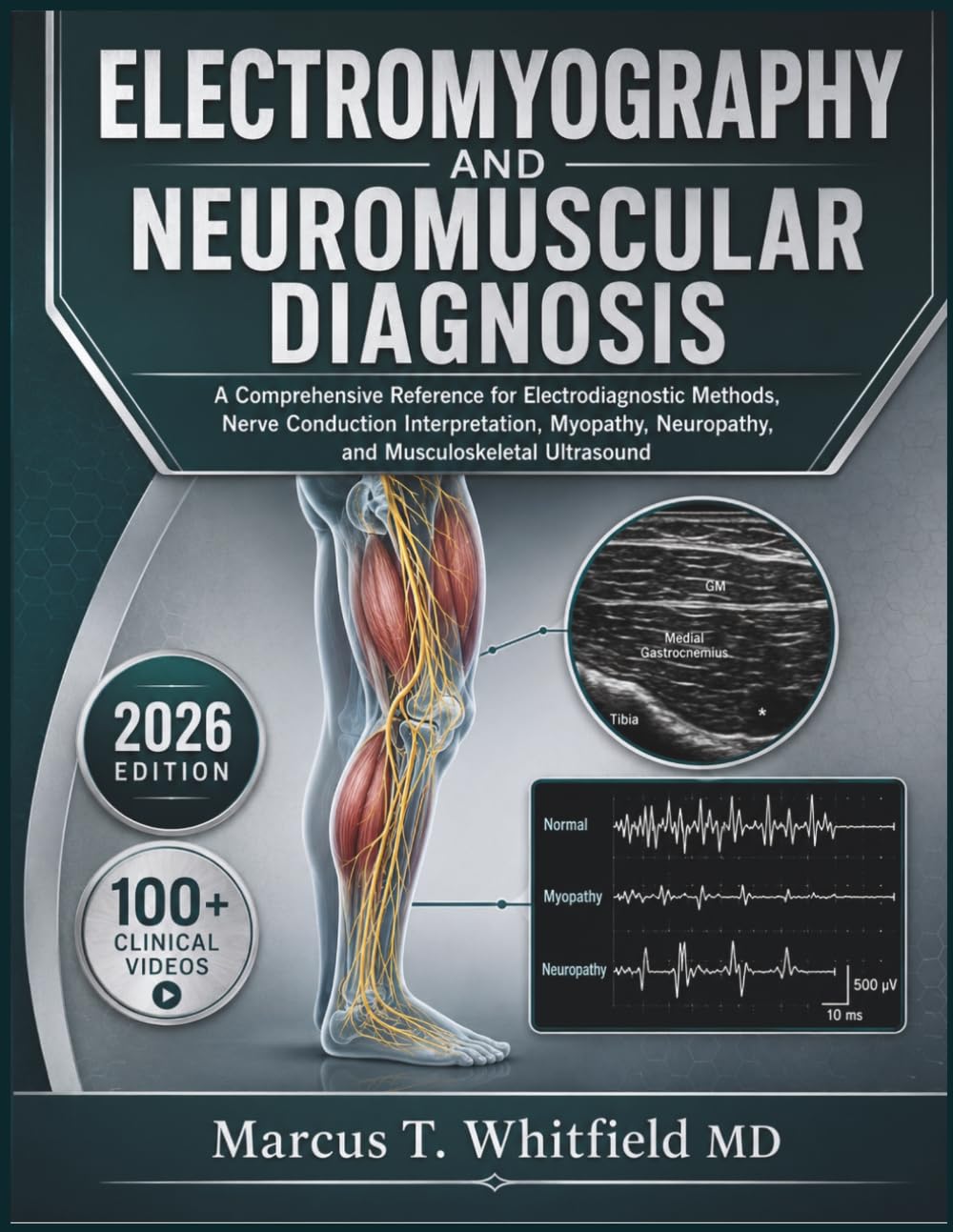 ELECTROMYOGRAPHY AND NEUROMUSCULAR DIAGNOSIS: A Comprehensive Reference for Electrodiagnostic Methods, Nerve Conduction Interpretation, Myopathy, Neuropathy, and Musculoskeletal Ultrasound