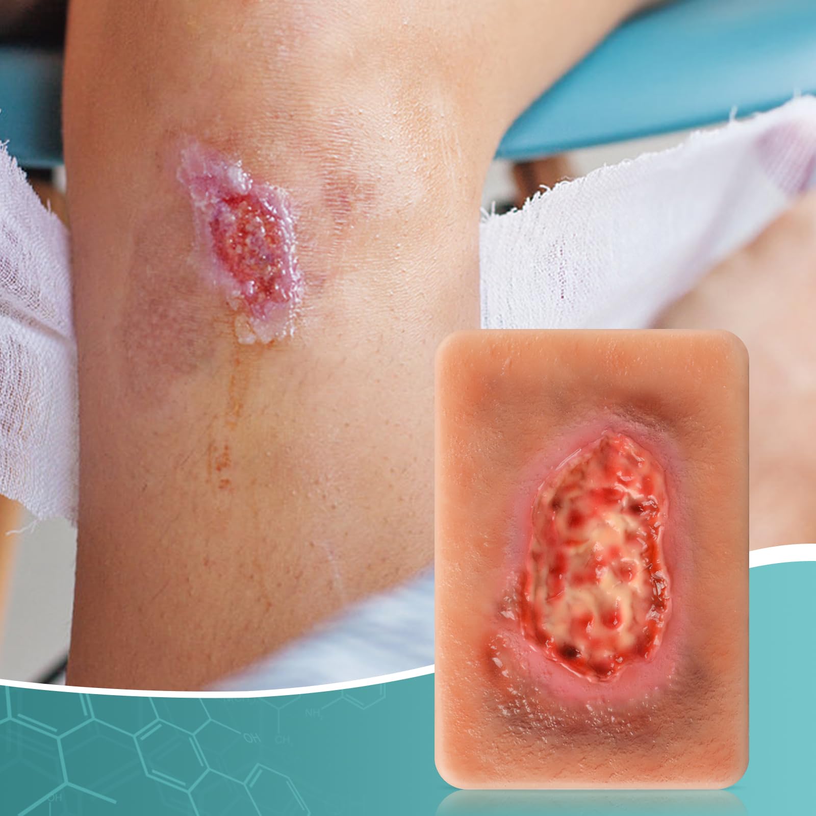 Lot de 3 outils d'entraînement pour plaies nécrotiques - Modèle de plaie de la taille de la paume