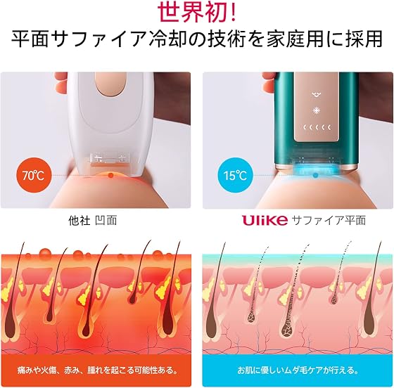 Ulike Air Pro IPL光美容器の商品画像