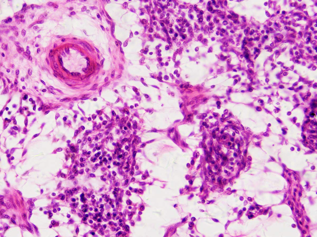 Bresser Muestras Preparadas: Histología