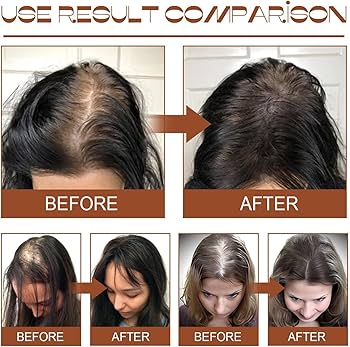 Batana Oil, Batana Oil for Hair Growth and Nourishment, Batana Oil