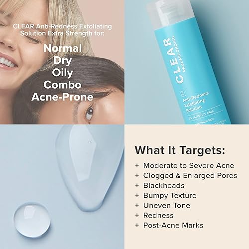 Miniatura 4 de Paulas Choice Extra Fuerza anti-enrojecimiento Exfoliante aclarante Solución con 2 BHA ácido salicílico para acnésevero4oz