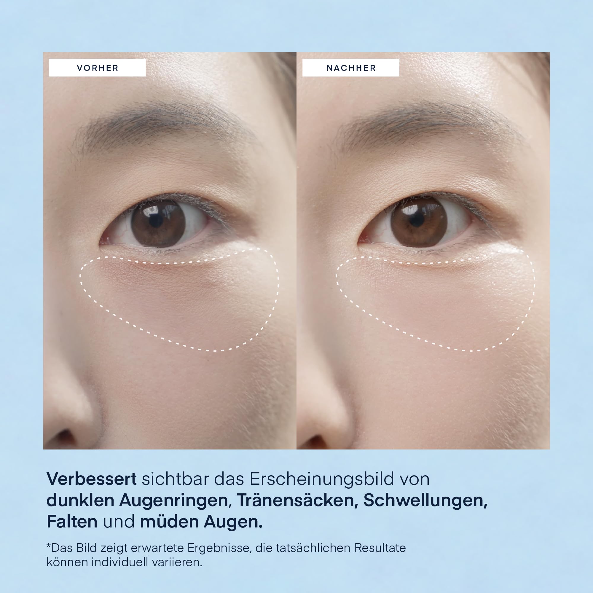 Augenpads gegen Augenringe Korean Skincare: Hyaluron & Koffein Augenpads gegen Tränensäcke & Falten - Vegan & Tierversuchsfrei, für empfindliche Haut geeignet Augenmaske, 30 Paare - Under Eye Patches
