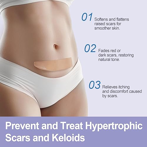Miniatura 8 de Cinta de silicona para cicatrices (rollo de 1.6 x 60 pulgadas – 4.9 ft), láminas de silicona de grado médico, hipoalergénicas para cicatrices nuevas