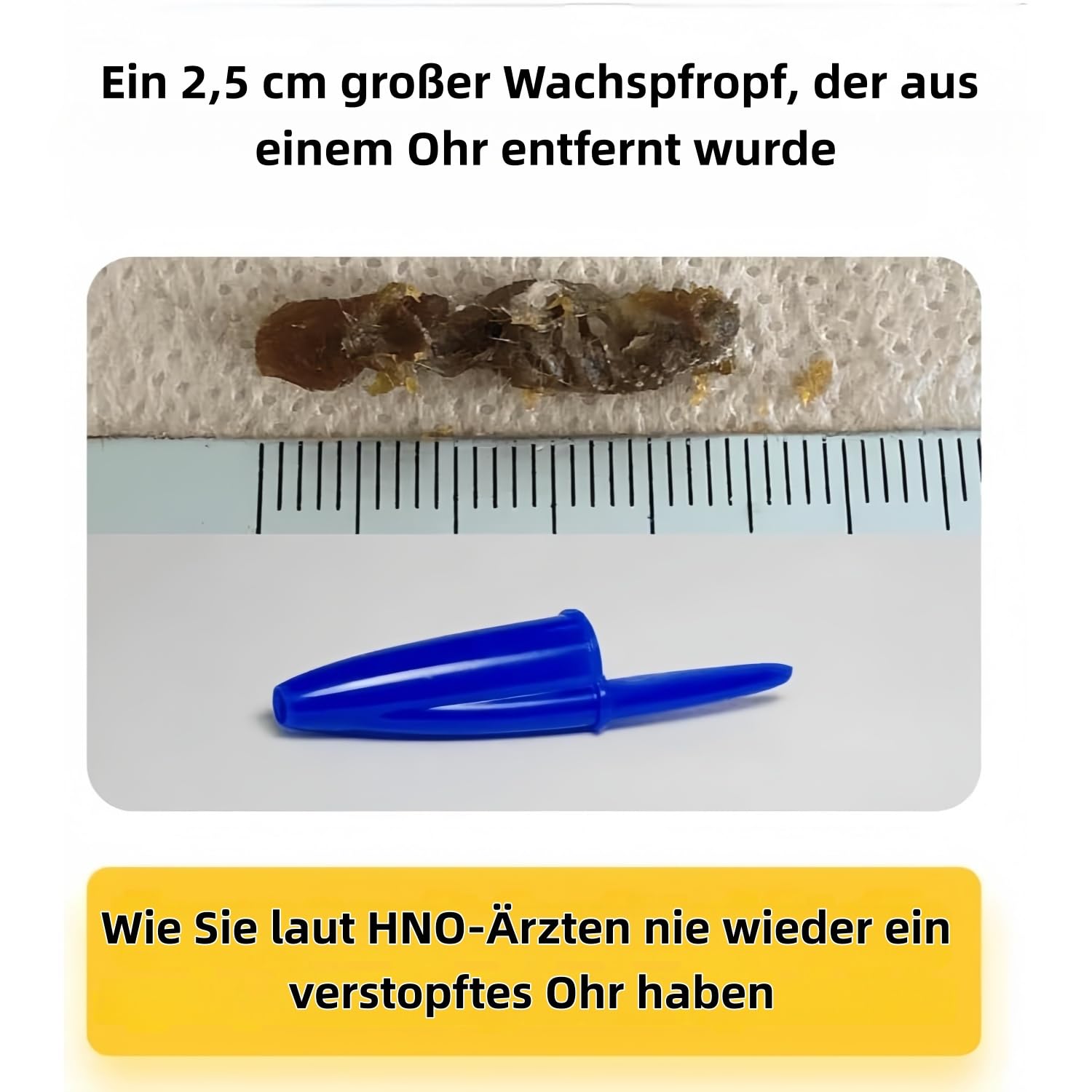 miluna pro plus intelligenter ohrenreiniger – Ohrenreiniger mit Kamera,1080P HD IP6X Ohrenreiniger mit LED-Beleuchtung, IP67 wasserdicht, ideal für Familien und Reisen (Weiß)