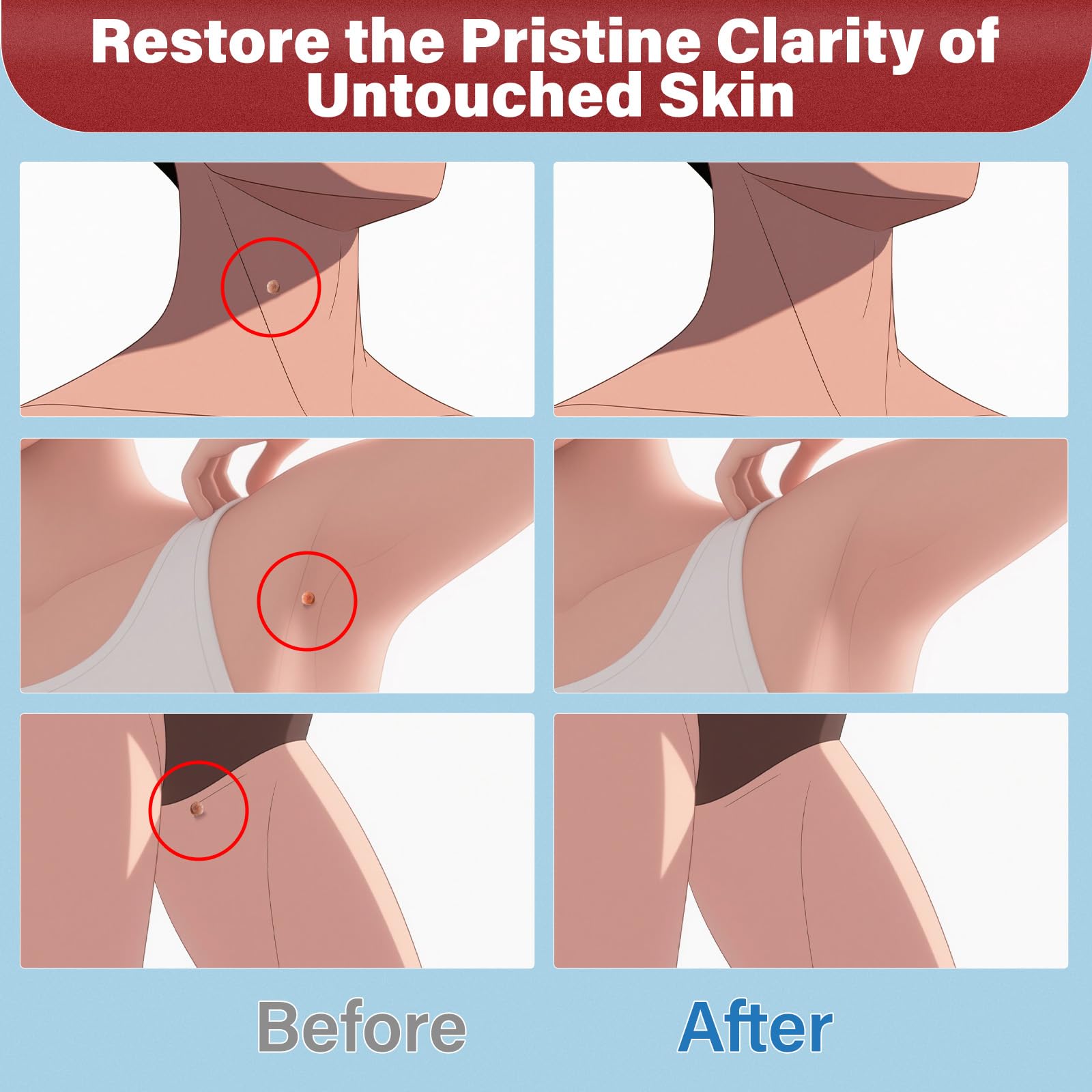 Image of Goodnites Fast-acting Skin Tag Removal Kit, Natural and Gentle Salicylic Acid Formula, Zero Pain Skin Tag Remover, Suitable for Neck, Underarms, Groin, Trusted by the Whole Family