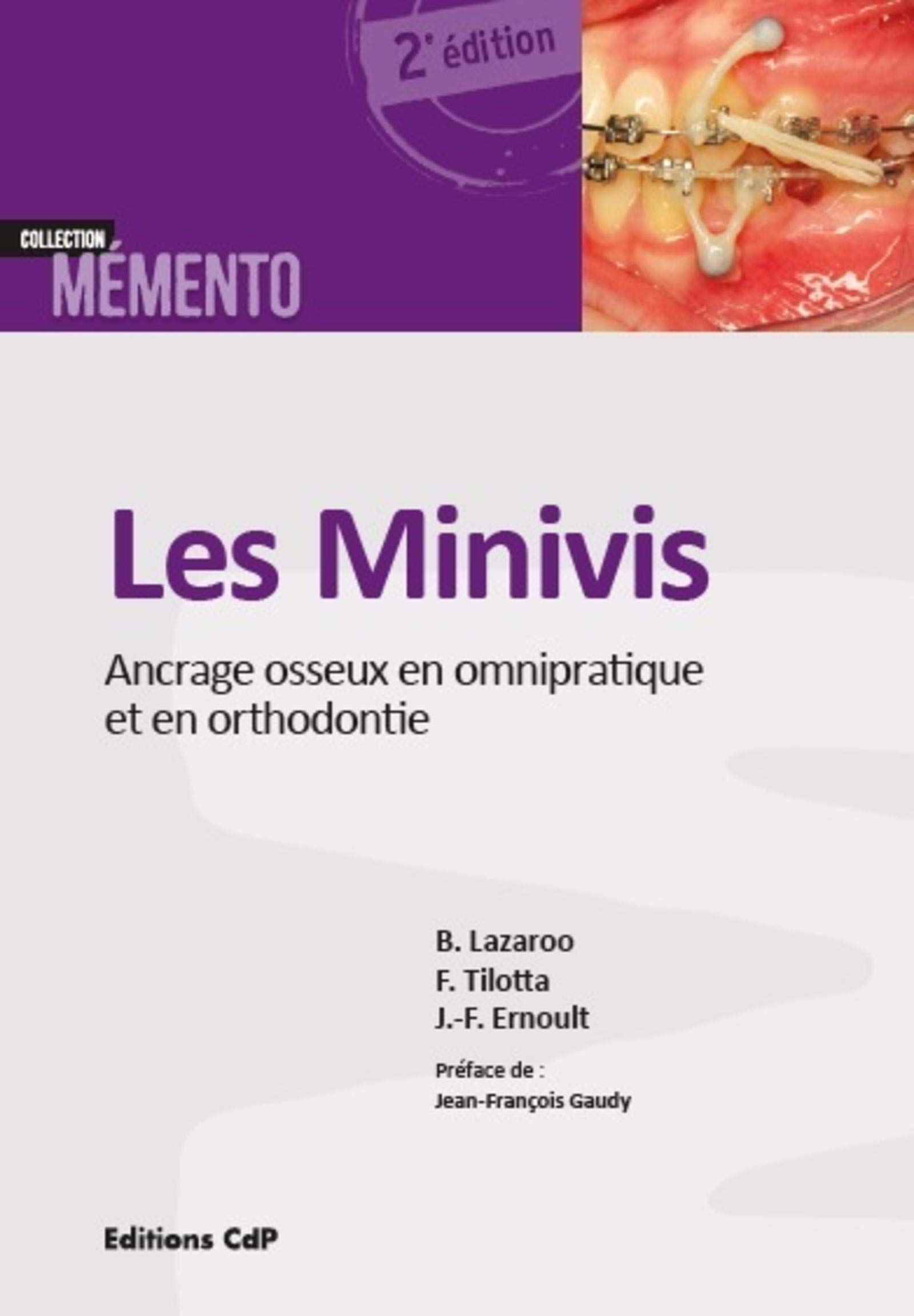 Les minivis: Ancrage osseux en omnipratique et en orthodontie.