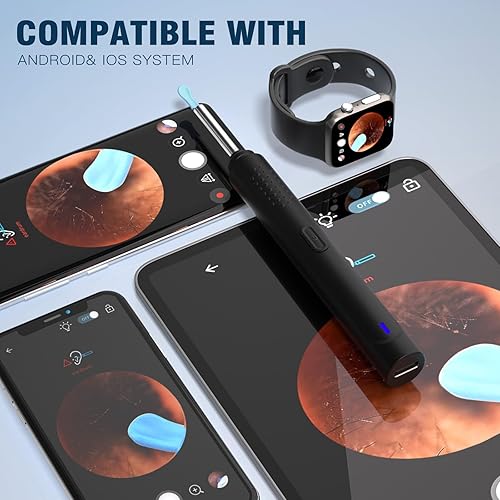 Miniatura 7 de vasdaren Eliminación de cera de oídos, limpiador de oídos con cámara con 1296P, kit de eliminación de cera de oídos con 9 juegos de orejas y 8