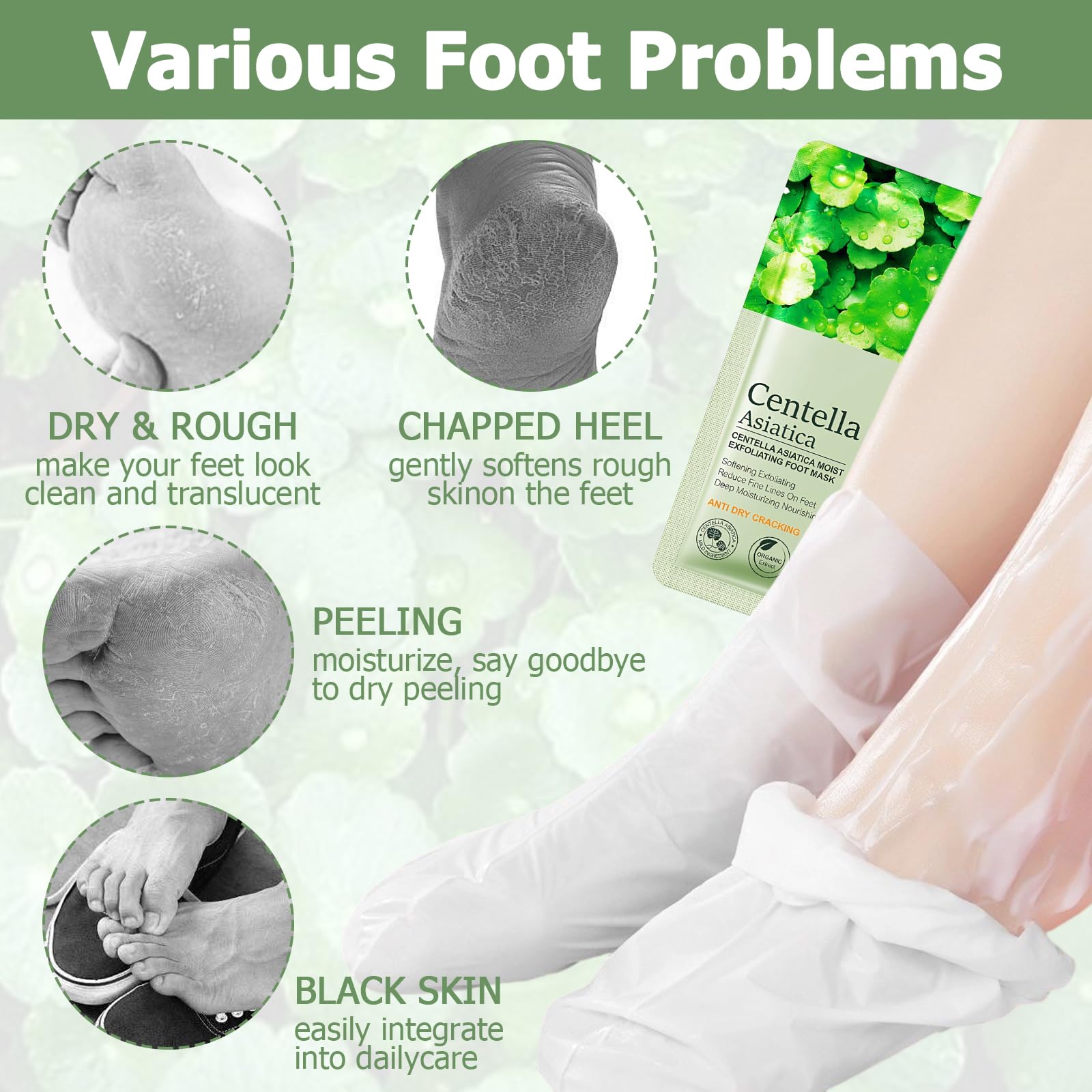 4 Paires De Masque Pieds Peeling Exfoliant, Peeling Pied, Masque Pieds Très Secs Et Abîmés Riches En Centella Asiatica, Nourrissant En Profondeur, Soin Doux, Convient Aux Hommes Et Aux Femmes