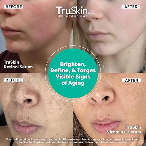 Miniatura 4 de TruSkin Naturals Suero facial Duo - Suero de retinol para la cara y suero de vitamina C antienvejecimiento para el cuidado de la piel para mujeres