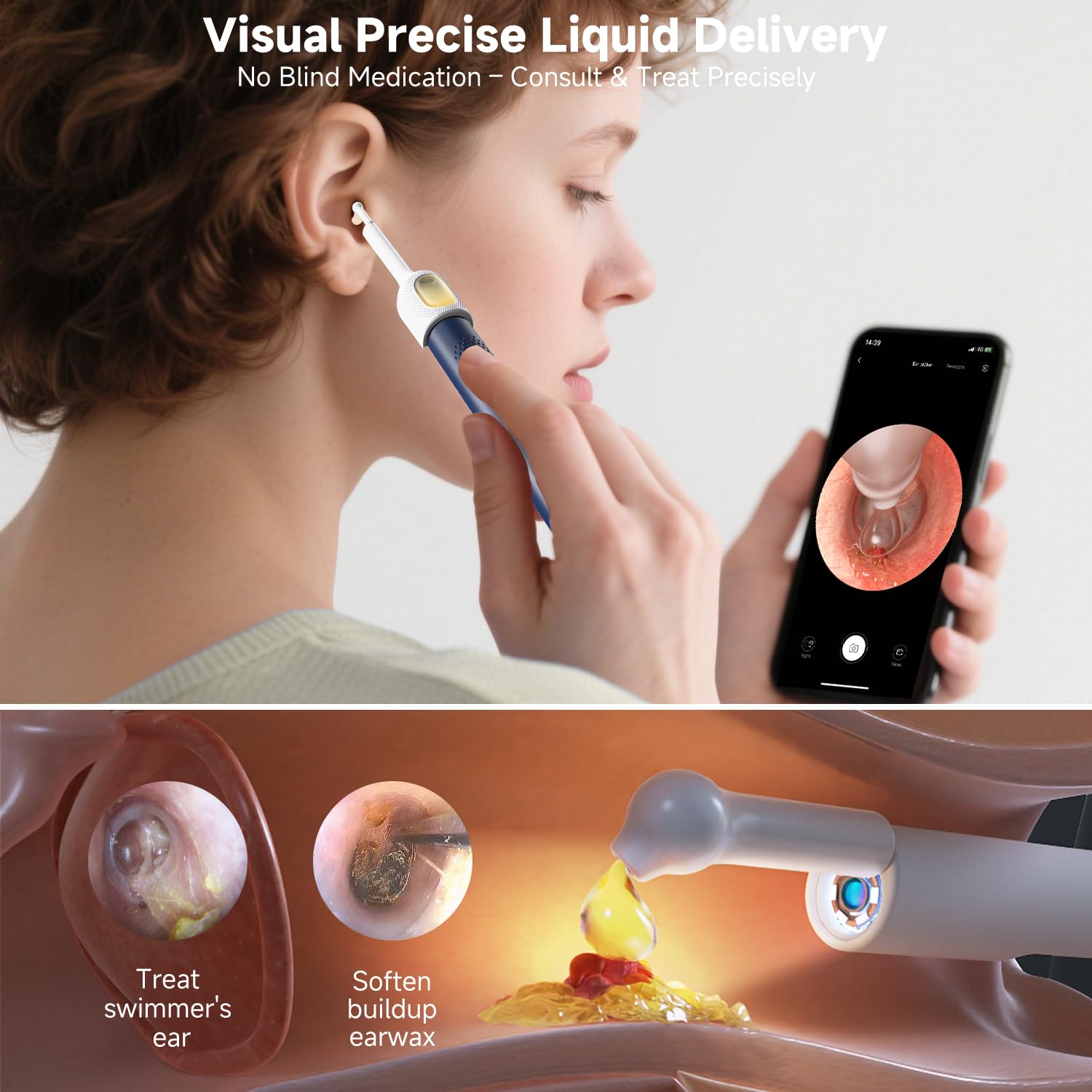 BEBIRD R1 Ear Camera: See & Remove Wax -6 BEBIRD R1 Ear Camera: See & Remove Wax -6