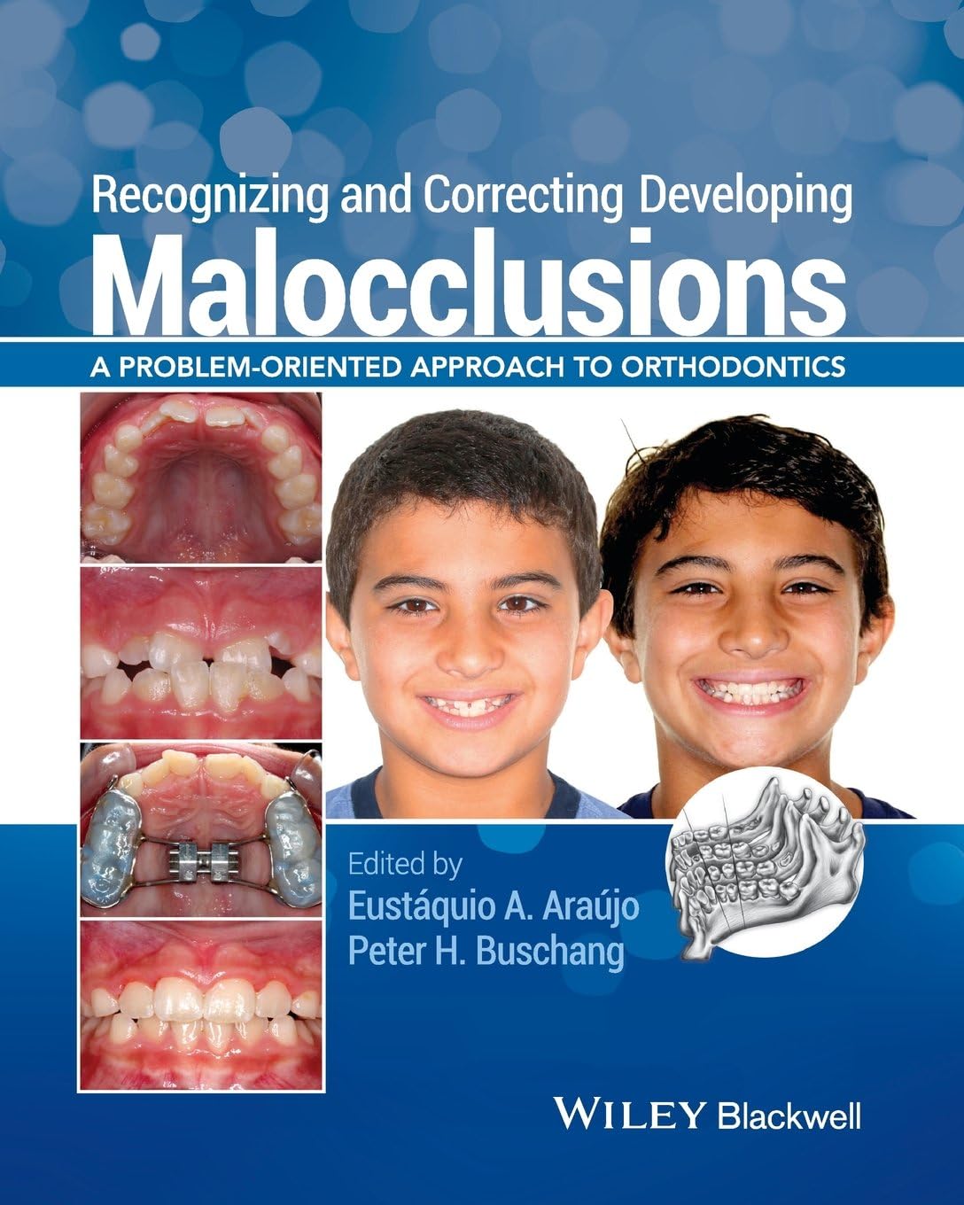 Recognizing and Correcting Developing Malocclusions: A Problem-Oriented Approach to Orthodontics 1st Edition