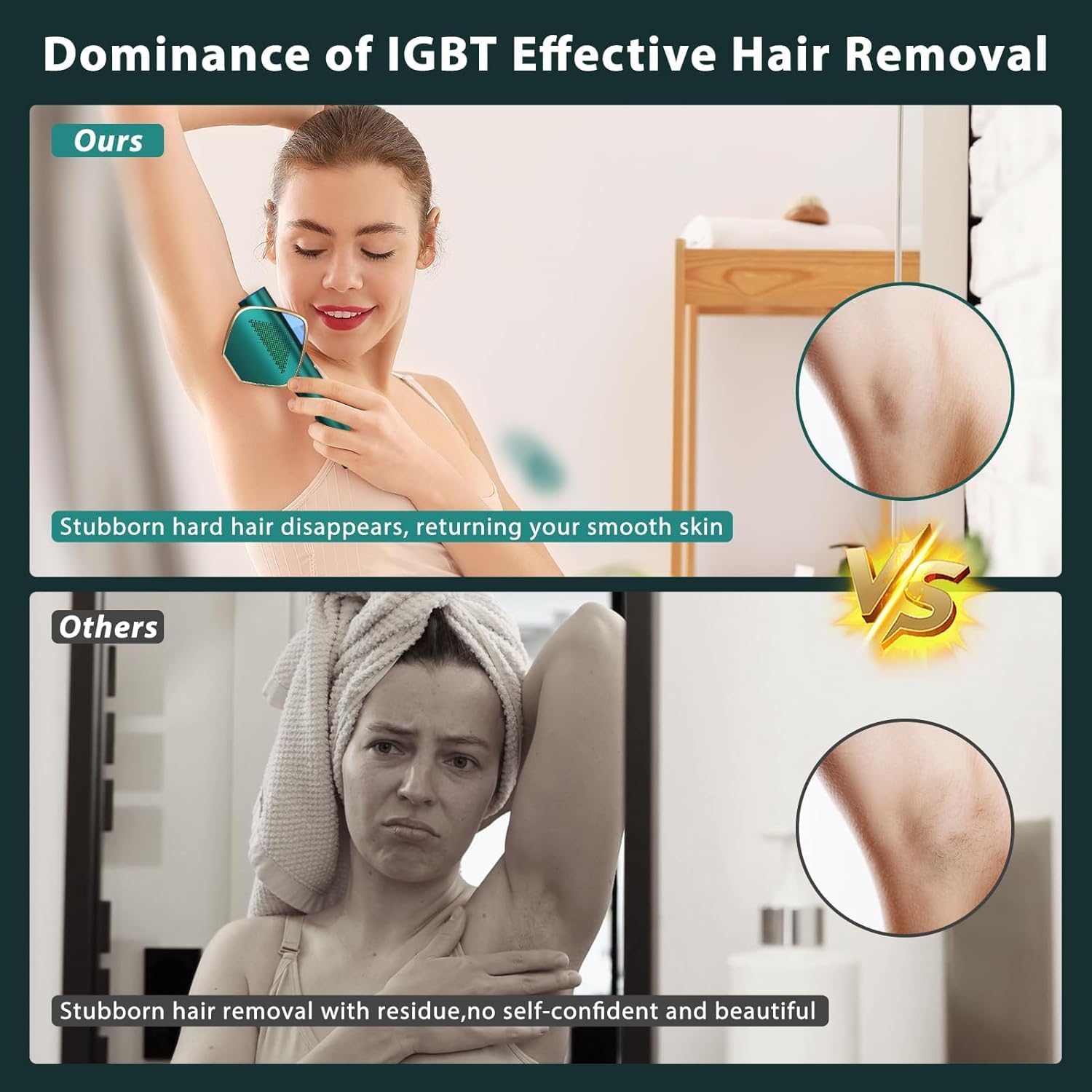 Amazon.com: IPL Laser Hair Removal for Women and Men, Long-Lasting