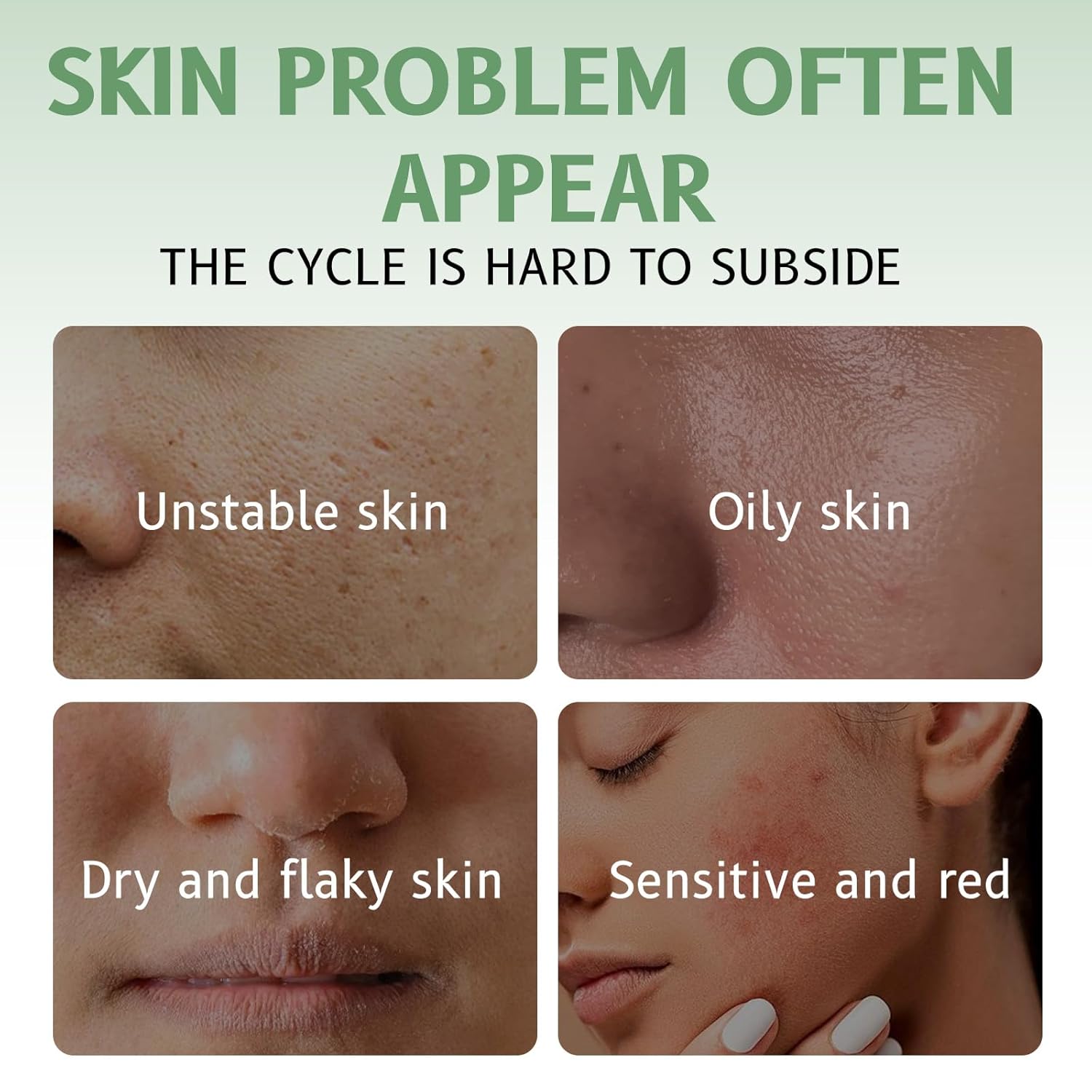 Centella Asiatica Intensive Hydration Cream, 85% Natural Ingredients, Long-Lasting Moisturizer for Sensitive Skin, 50g - Image 5