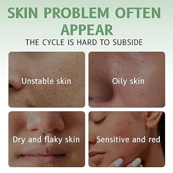 Centella Asiatica Intensive Hydration Cream, 85% Natural Ingredients, Long-Lasting Moisturizer for Sensitive Skin, 50g