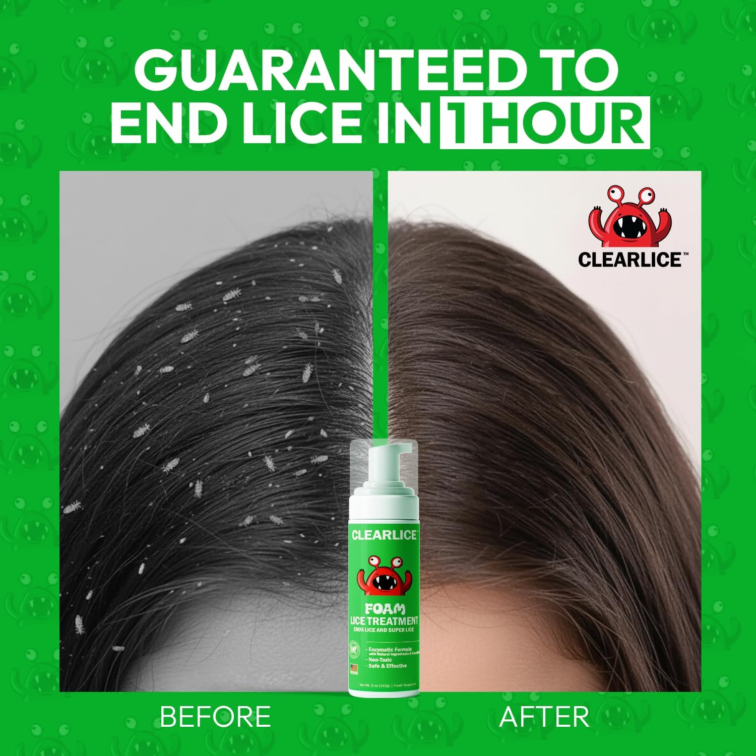 Lice Treatment Foam for Kids & Adults – Extra Strength Natural Enzyme Formula – Guaranteed to Remove Lice Nits Eggs in 1 Hour - Non-Toxic & Made in USA (5 Oz) - Image 4