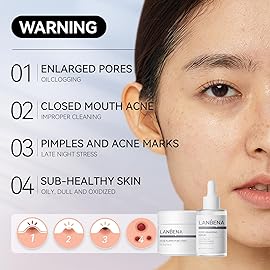 LANBENA 3 in 1 Blackheads Removing Kit, Nose Pore Strips 30g+Pore Serum 30ml+ Strip Paper, Black Head Remover Mask for Nose, Pore Minimizer for Face