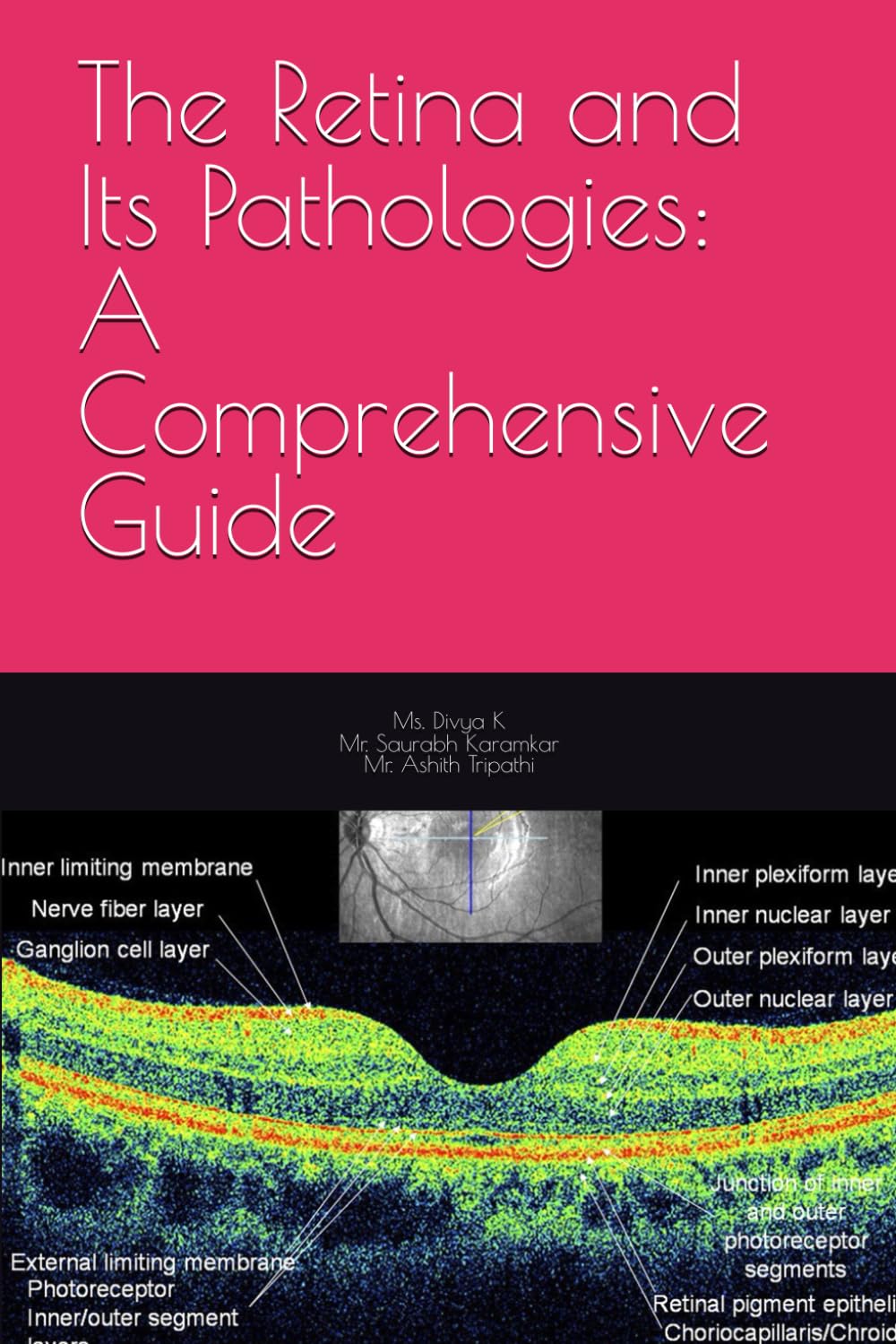 The Retina and Its Pathologies: A Comprehensive Guide