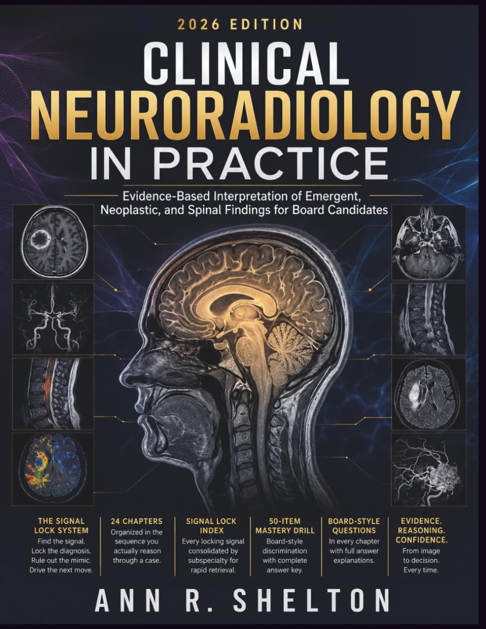 Clinical Neuroradiology in Practice: Evidence-Based Interpretation of Emergent, Neoplastic, and Spinal Findings for Board Candidates