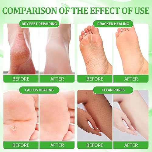 Miniatura 111 de Kit de pedicura para pies remojados: sal de burbujas, exfoliante de azúcar, máscara de masaje, loción de masaje en una caja, kit de spa de 4 pasos