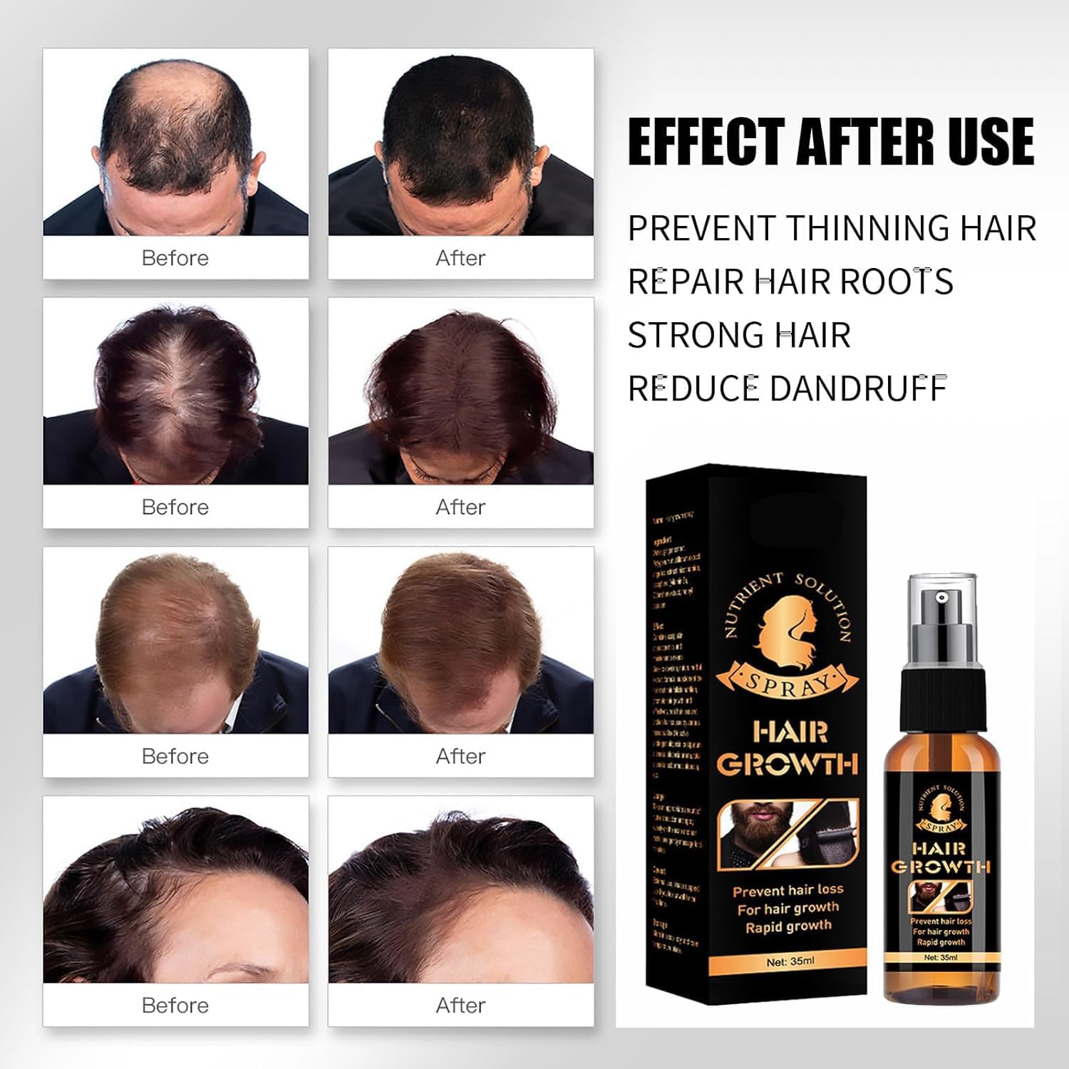 Premium-Biotin-Haar- und Bart-Booster, Premium-Biotin-Haar- und Bart-Spray-Booster für Männer, Haarwuchs-Serum-Spray für Haare und Bart, Bartspray, Bartwuchs