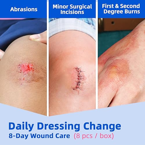 Miniatura 3 de Apósito de espuma de silicona Lite de 4 x 4 pulgadas, borde suave para heridas, incisiones quirúrgicas, quemaduras, abrasiones, apósito de grado