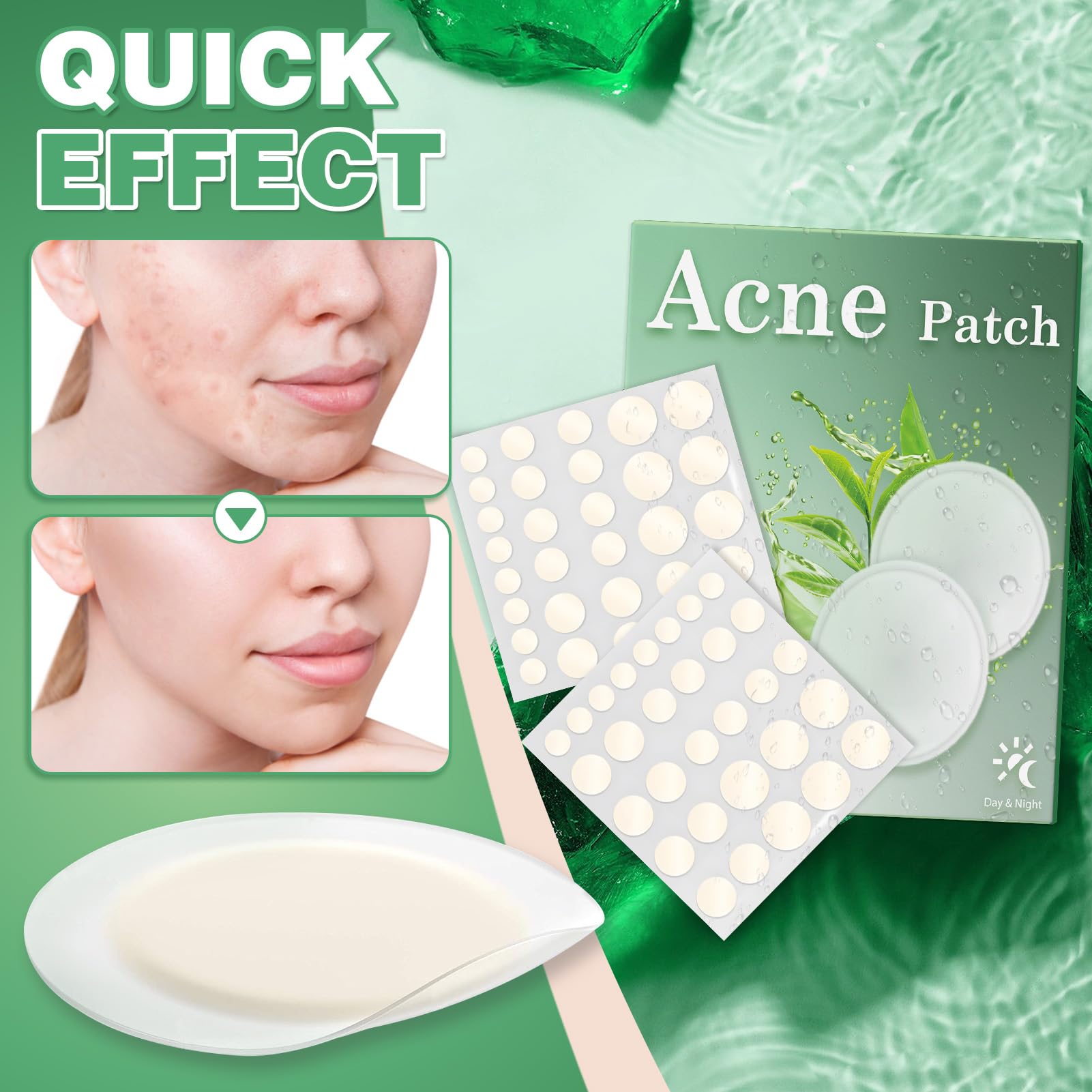 24 Patchs Anti-boutons Hydrocolloïdes Glacia - Pour Tous Types De Peau - Aux Huiles Naturelles - Neuf
