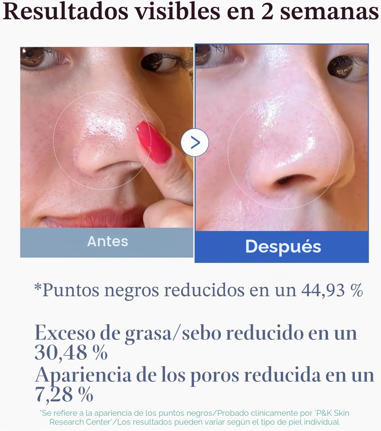 Medicube ZERO PORE PAD 2.0, 70 Piezas - Almohadillas Faciales Exfoliantes Suaves con AHA, BHA, PHA, Centella Asiática y Árbol de Té para Tratamiento de Piel